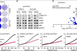 New Therapy Identified for MPNST in NF1